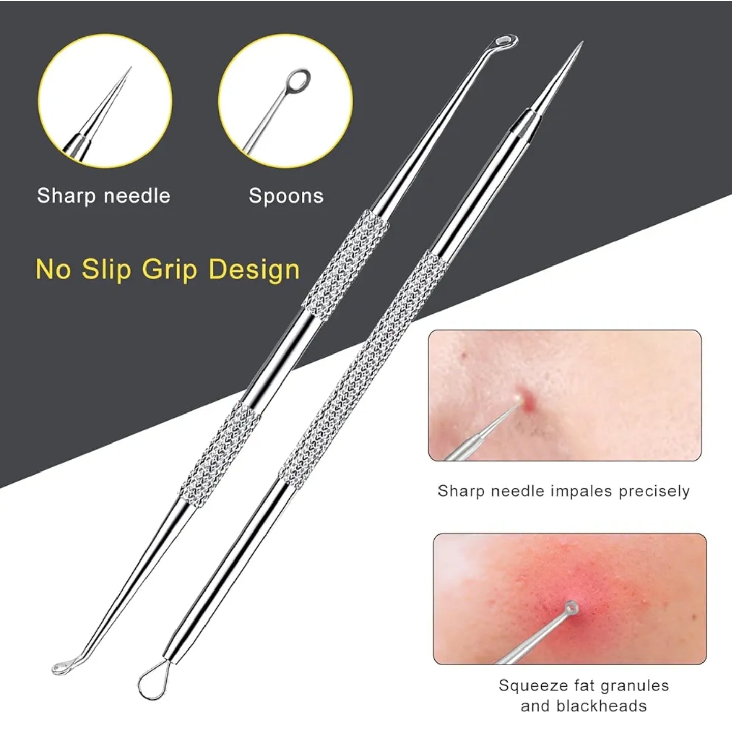 10 Pcs Professional Pimple Extraction Kit